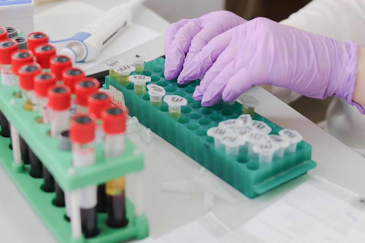 laboratory, medical, medicine, hand, research, lab, test, doctor, equipment, scientist, woman, chemistry, science, hospital, experiment, person, technician, technology, healthcare, working, health, tube, work, research lab, blood samples, laboratory, lab, lab, lab, lab, lab, scientist