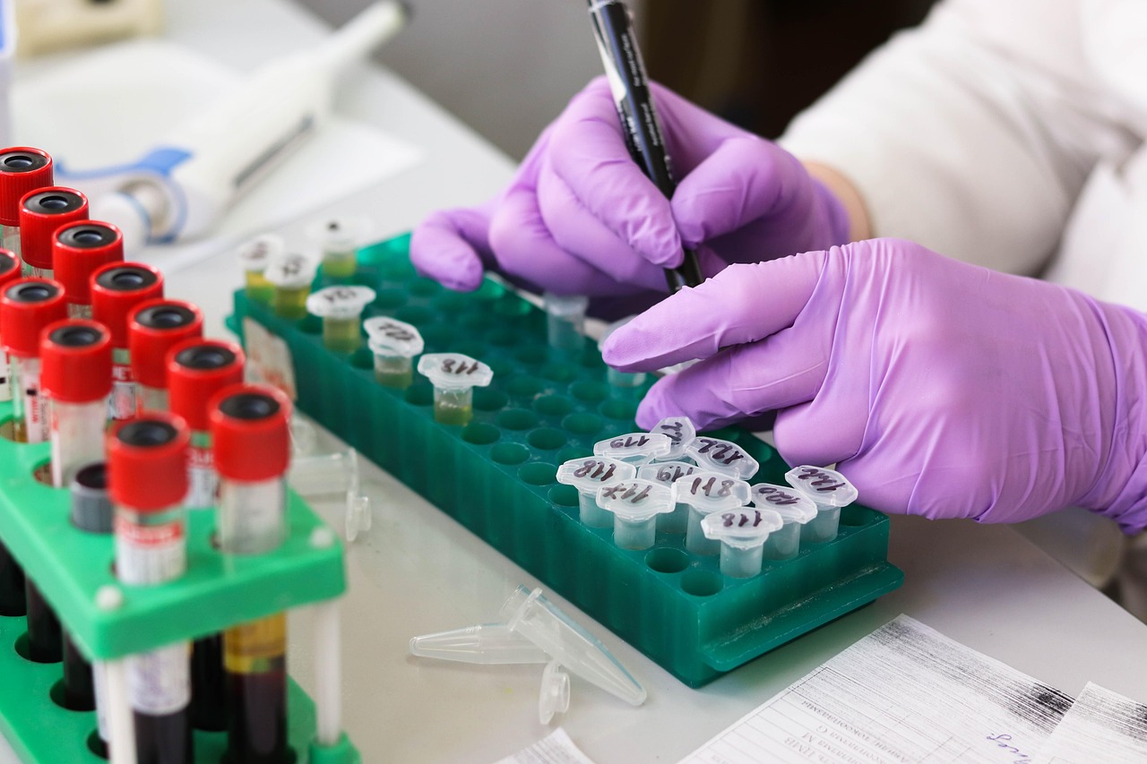 laboratory, medical, medicine, hand, research, lab, test, doctor, equipment, scientist, woman, chemistry, science, hospital, experiment, person, technician, technology, healthcare, working, health, tube, work, research lab, blood samples, laboratory, lab, lab, lab, lab, lab, scientist, scientist