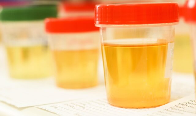 laboratory, medical, medicine, hand, research, lab, test, doctor, equipment, scientist, woman, chemistry, science, hospital, experiment, person, technician, technology, healthcare, working, health, tube, work, research lab, blood samples, laboratory, laboratory, laboratory, laboratory, laboratory, lab